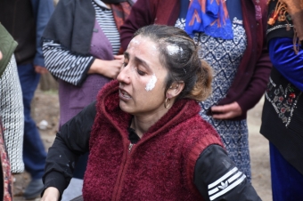 [b]Yataqxana yanğınında xəsarət alanlarla bağlı SON MƏLUMAT[/b]