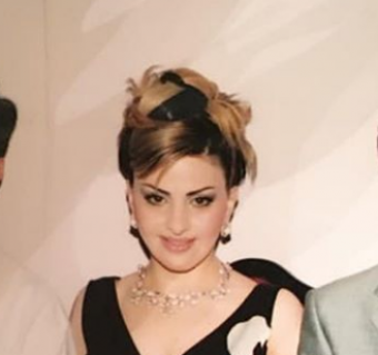 <b>Mətanət Əsədova 15 il öncə belə olub: <span style="color:red;">"Plastik əməliyyat..."</b> 