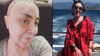 Xərçəngdən əziyyət çəkən modelyer yeni fotosunu paylaşdı