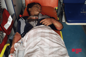  Kürəkənin yandırdığı qadının vəziyyəti ağırdır