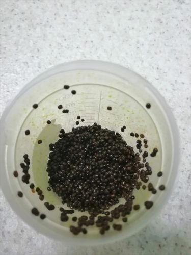 Xəstənin öd kisəsindən 4 minə yaxın daş çıxarıldı - HEYRƏTAMİZ ƏMƏLİYYAT