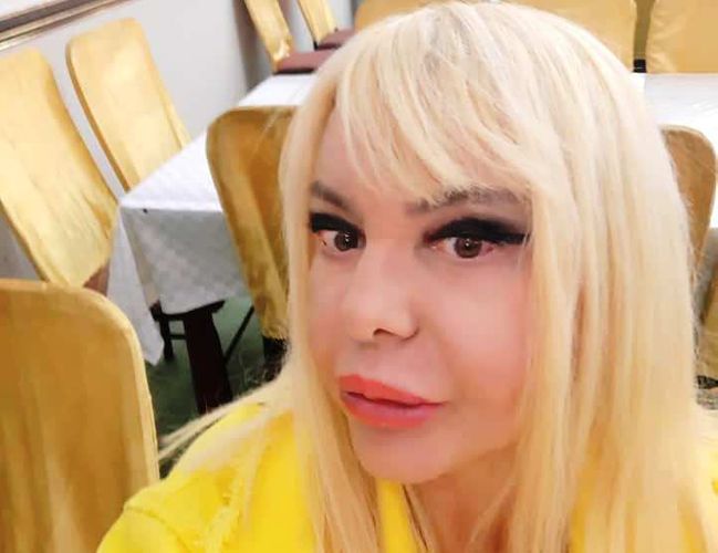 "Elit-star" Cəmilə əməliyyatdan sonra belə oldu - FOTOLAR