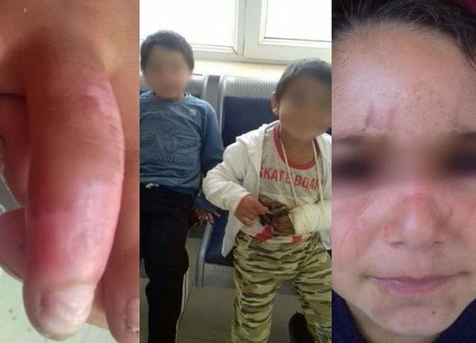 “Bizi dağlayır, çiy kartof yedirirdilər...” - İşgəncə verilən uşaqlar və baba danışdı - FOTOLENT