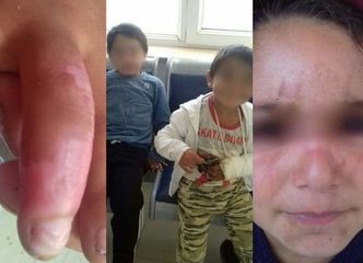 “Bizi dağlayır, çiy kartof yedirirdilər...” - İşgəncə verilən uşaqlar və baba danışdı - FOTOLENT