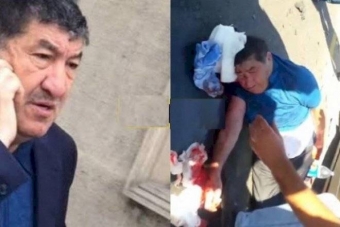 Hacı Mazanın HƏKİMİ DANIŞDI: "Çoxsaylı sınıqlar var və... " - YENİLƏNİB