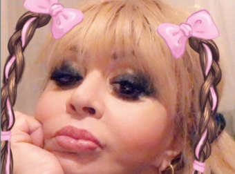 Əməkdar artistin <span style="color:red;">SİLİKONLARI  müzakirə olundu- <span style="color:red;">FOTOLAR 