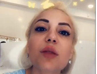 <b>Səidə özünü bu hala saldı - <span style="color:red;">DODAĞIN BÖYÜTDÜRDÜ və...  - FOTOLAR</b>