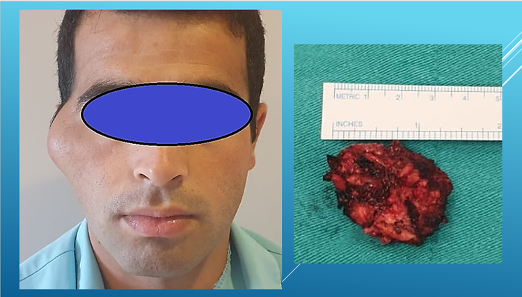 Bakıda daha bir qeyri-adi əməliyyat keçirildi