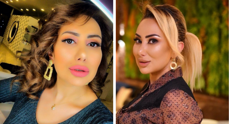 Təranə dəyişildi, tanımadılar - FOTO 