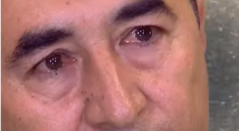 Xalq artistimiz xəstə imiş: <span style="color:red;">"Saçlarım töküldü və..."  - <span style="color:red;">VİDEO 