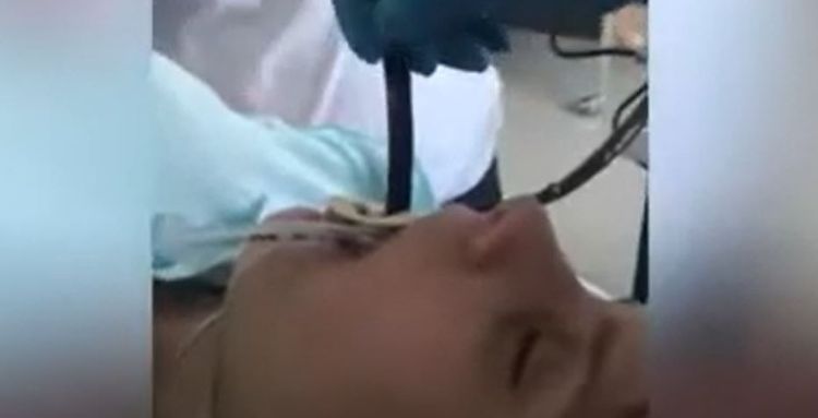 Həkimləri şoka salan HADİSƏ: Qadının mədəsinə 1 metrlik ilan girdi - VİDEO