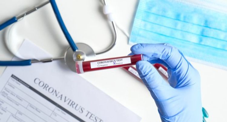 Türkiyənin “qol kralı” koronavirusa yoluxdu