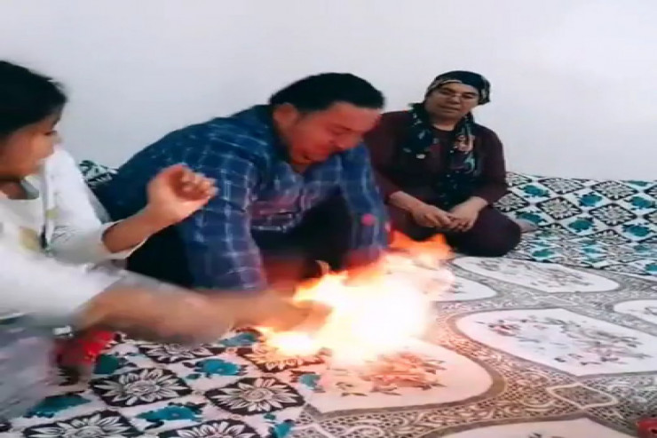 “TikTok”a görə ərinin əllərini yandırdı