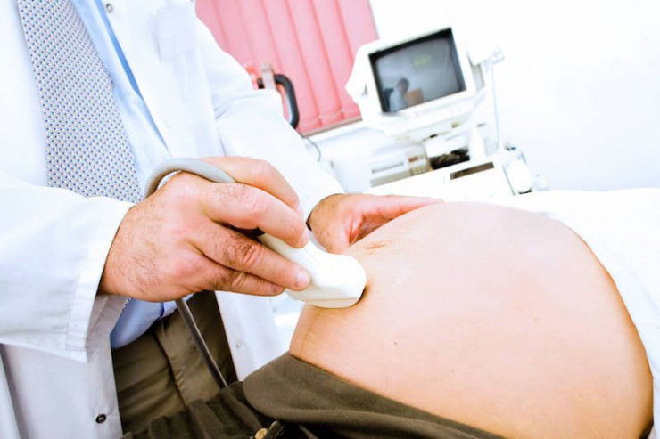 40 il xəstələrini mayalandıran həkim 9 min uşaq atası oldu