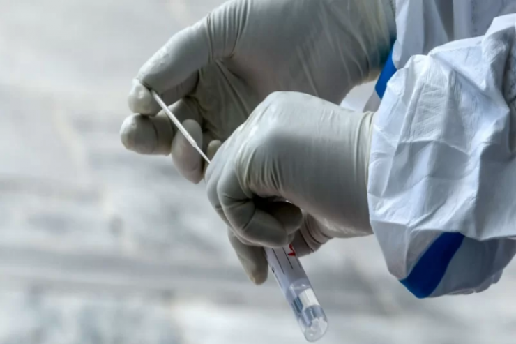 Pulsuz koronavirus testləri ilə bağlı bütün suallara CAVAB 