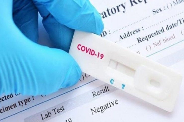 Azərbaycanda nə qədər koronavirus testi var? - RƏSMİ 