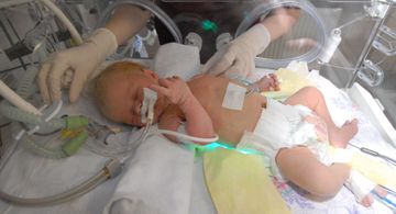 Yeni doğulan uşaq anasından koronavirusa yoluxdu 