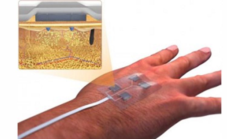  “Ağıllı” sarğı bandajı tez-tez dəyişdirmək ehtiyacını aradan qaldıracaq - YENİLİK