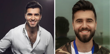 "Eurovision" təmsilçimiz dəyişildi: "Qayıtdım..." - FOTOLAR