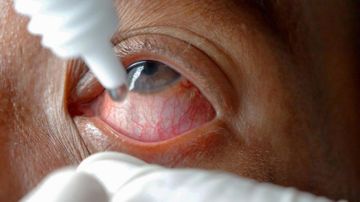 Zorakılıqla üzləşən qadından İNANILMAZ addım: ərini göz damcısı ilə ...