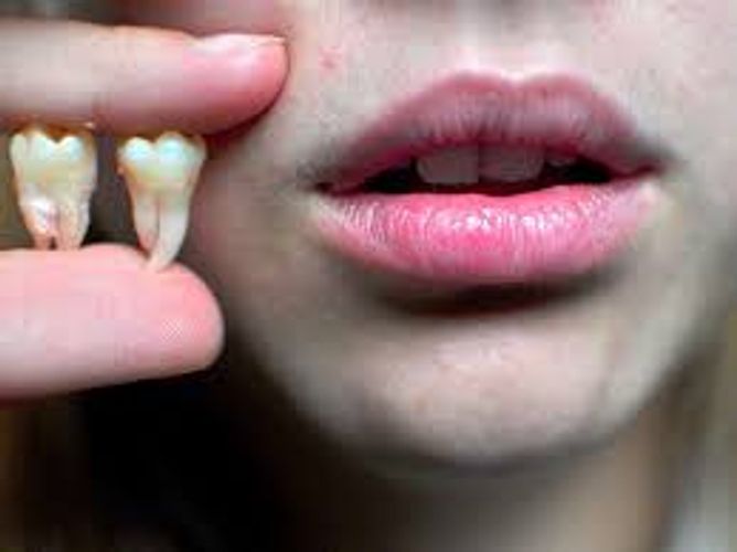  Diş çürükləri ölümə səbəb ola bilər
