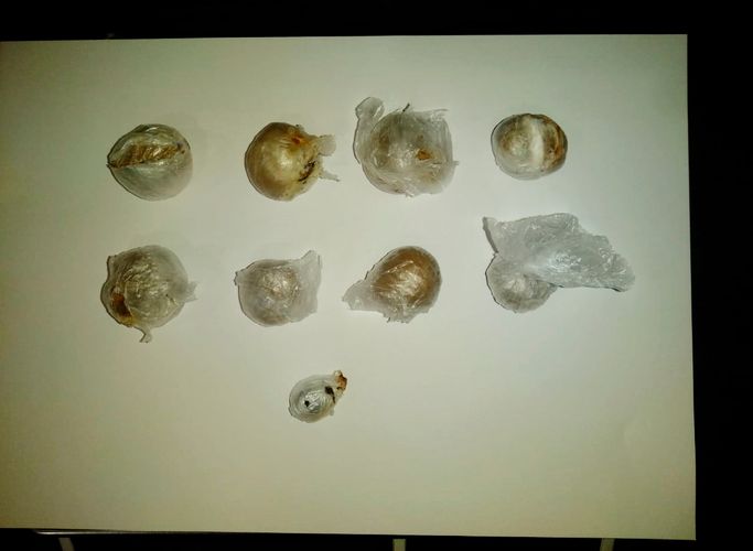 İrandan bağırsağında narkotik keçirən saxlanıldı 