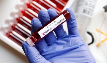 London klubunun futbolçusu koronavirusa yoluxdu