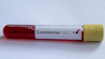 ABŞ-dan koronavirusa görə Azərbaycan və Gürcüstanla bağlı QƏRAR