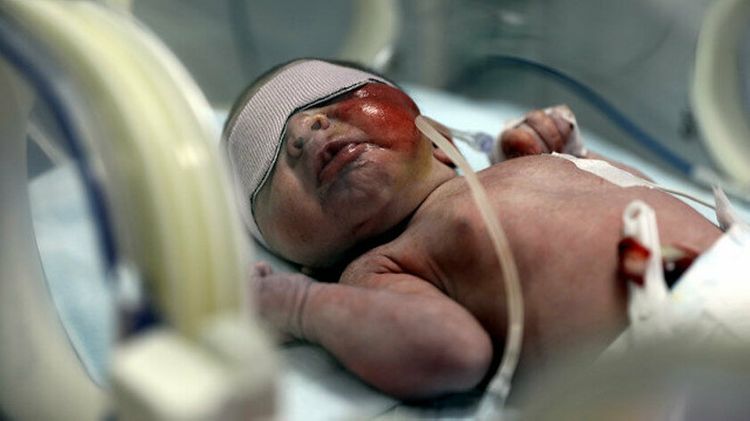 Zibil qutusundan təzə doğulan uşaq tapıldı - VİDEO