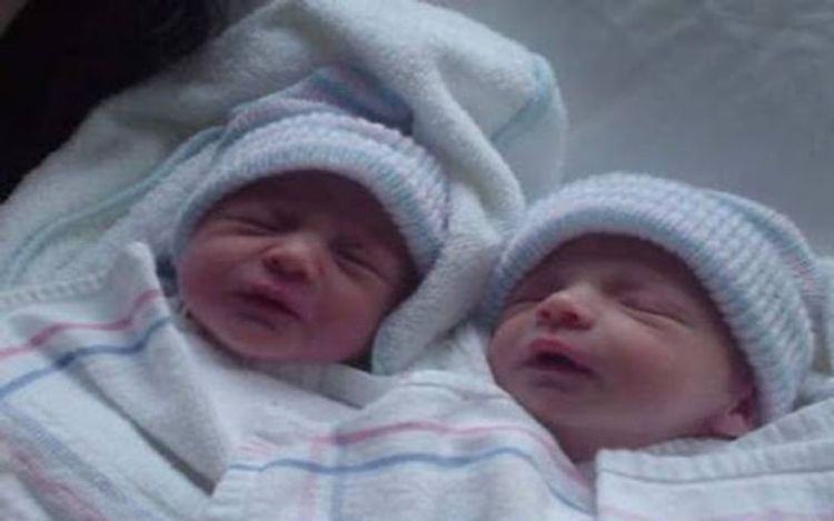 Bakıda həkimlər əkiz körpələrdən birini oğurlayıb? - RƏSMİ CAVAB
