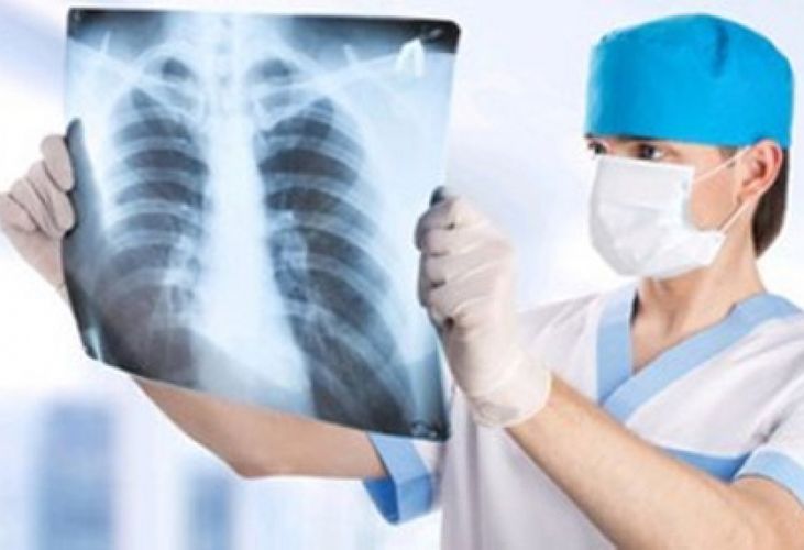 Azərbaycanda ağciyər xəstələrinin sayı artacaq - XƏBƏRDARLIQ