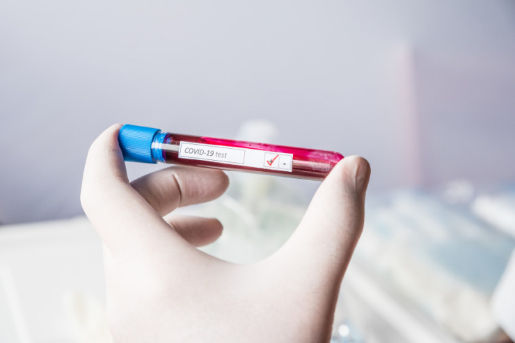 Tanınmış vəkil koronavirusa yoluxdu