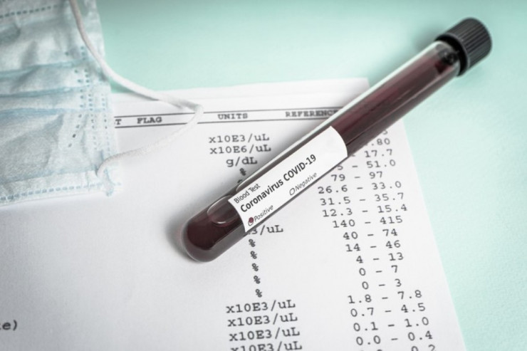 Dörd dəfə koronavirusa yoluxdu