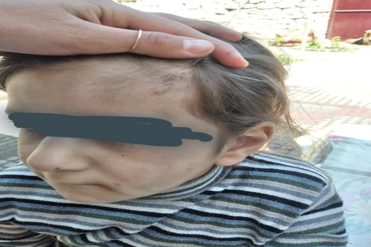 Atası tərəfindən şiddətə məruz qalan uşaq