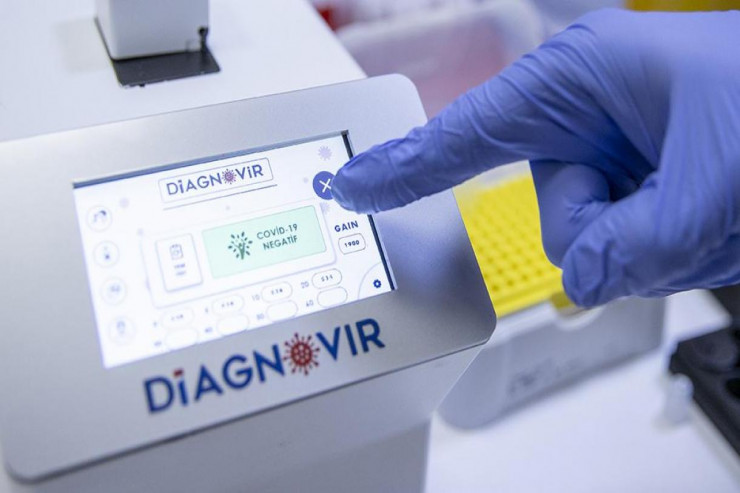 Koronavirusu 10 saniyədə tanıya bilən ciyahız istehsalına başlanıldı -FOTO 