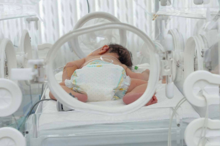Bakıda ŞOK:  COVID olan ana süni nəfəs aparatına qoşulu uşaq doğdu - FOTO 