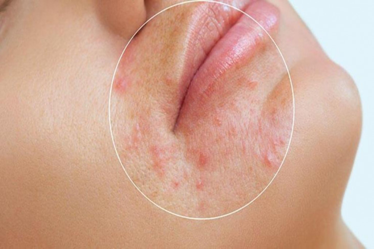 Günəş şüaları dərini qocaldır