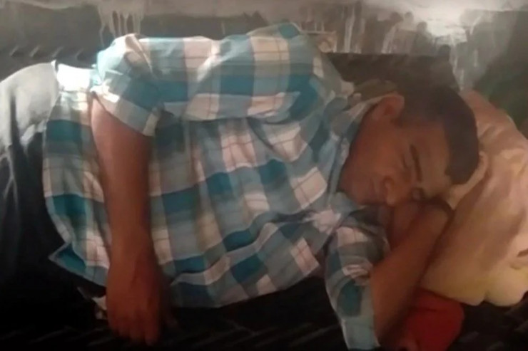 Ailəsi onu yuxuda çimizdirir və yedizdirir – nadir xəstəlik -FOTO 