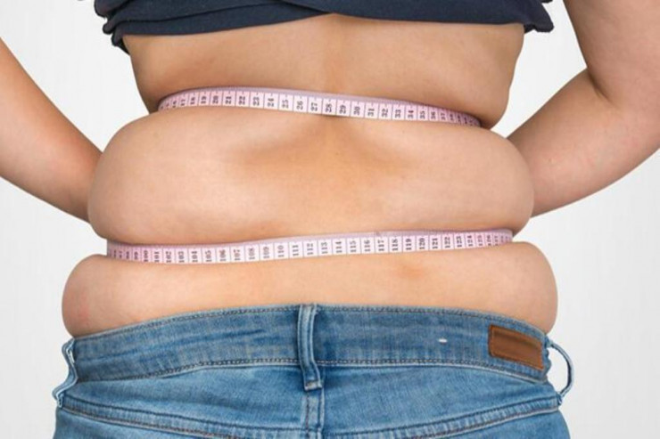 Mədəkiçiltmə əməliyyatından sonra əməl olunmalı 5 VACİB MƏQAM  