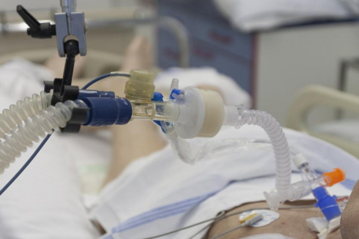 Azərbaycanda ŞOK:  koronavirusdan ölən qadının qızıl dişləri oğurlandı