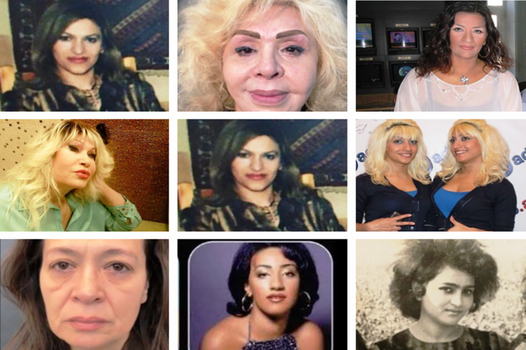 Şou-biznesdəki qadınların  ƏVVƏLKİ , SONRAKI HALI  - FOTOLAR 