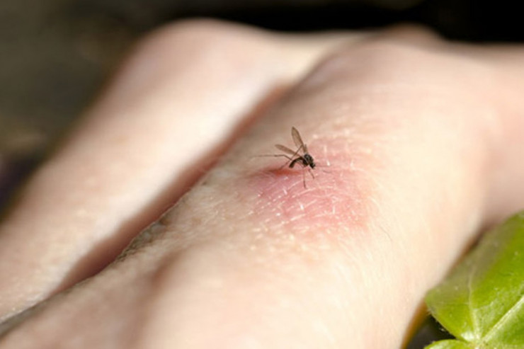 Ağcaqanad dərmanlarından  İMTİNA  etmək lazımdır