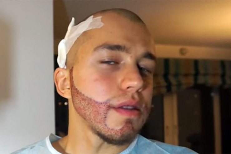 Sergey Romanoviç əməliyyatdan sonra