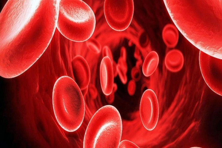 Qeydiyyatda olan talassemiya xəstələrinin sayı AÇIQLANDI 