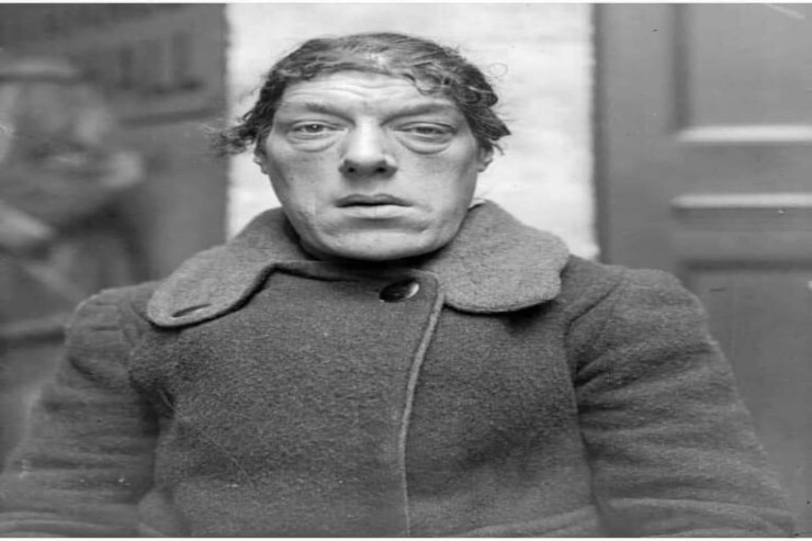 Dünyanın ən çirkin anası Mari