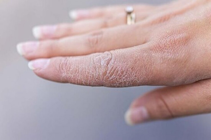 Quru əlləriniz üçün faydalı məsləhətlər: 4 MASKA 