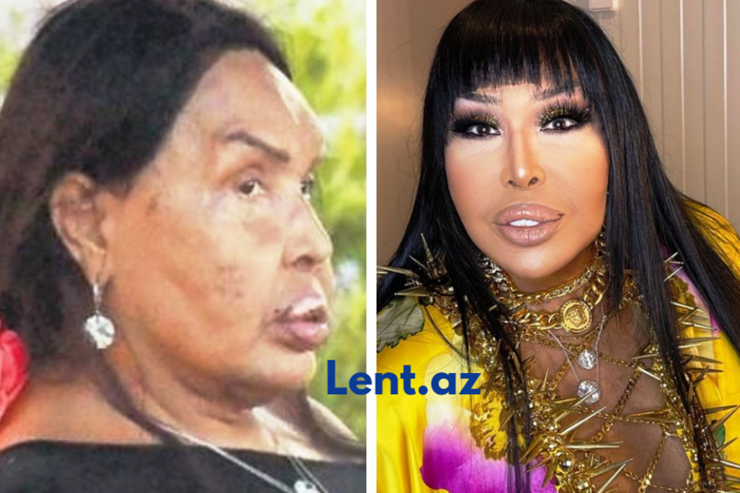 Müğənni Bülənt Ərsoy