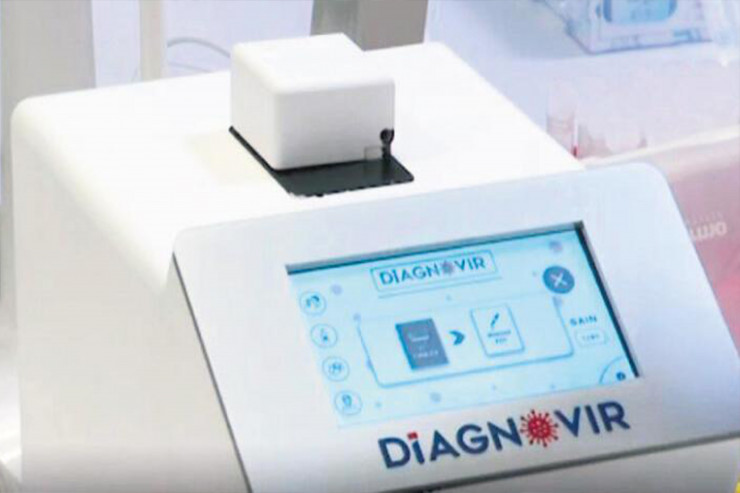 Koronavirusu 10 saniyədə aşkar edir -  ŞOK YENİLİK  