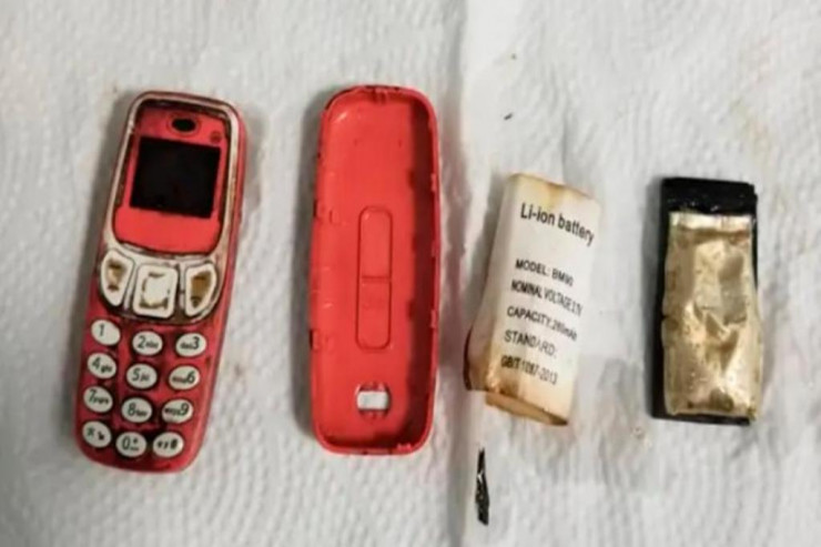 Cib telefonunu uddu: Hissə-hissə çıxardılar 