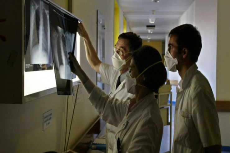 Ağciyərlərdə yaranan buzlu şüşənin ən effektli müalicəsi... 